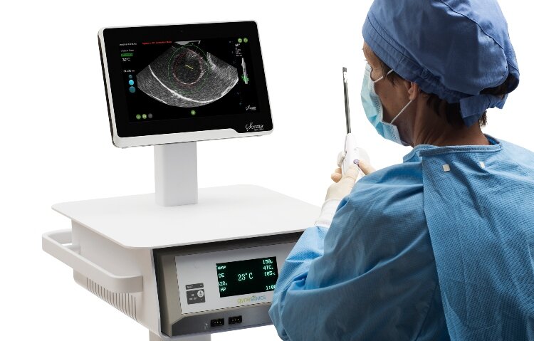 The treatment uses ultrasound and radio wave technology. (Holland Hospital)